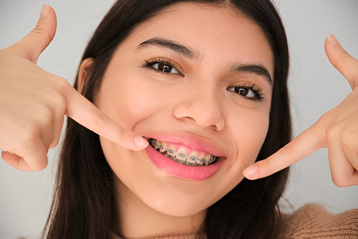 braces near you