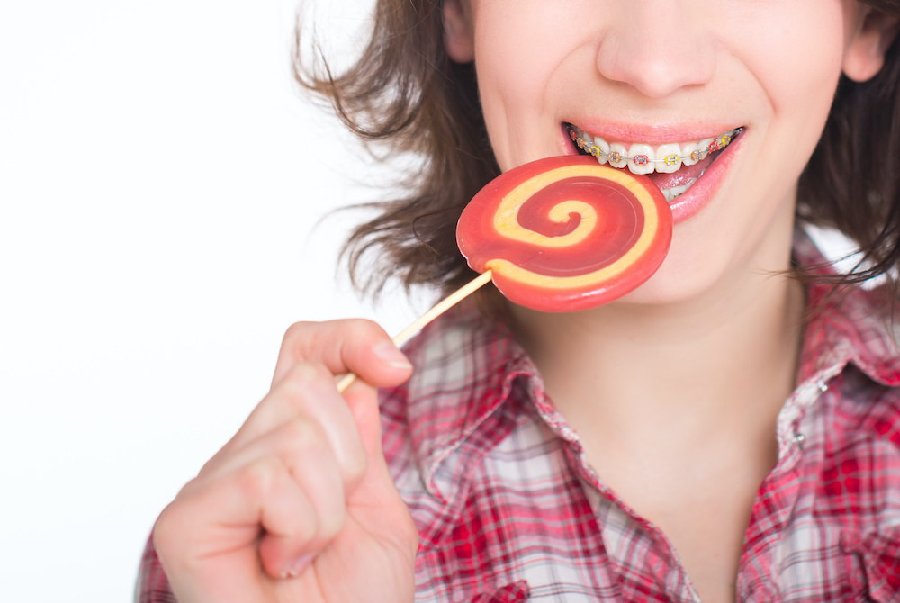 dental care what not to eat with braces
